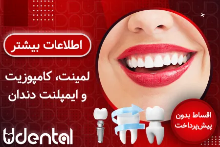 نمونه طراحی بنر همسان در زمینه دندانپزشکی
